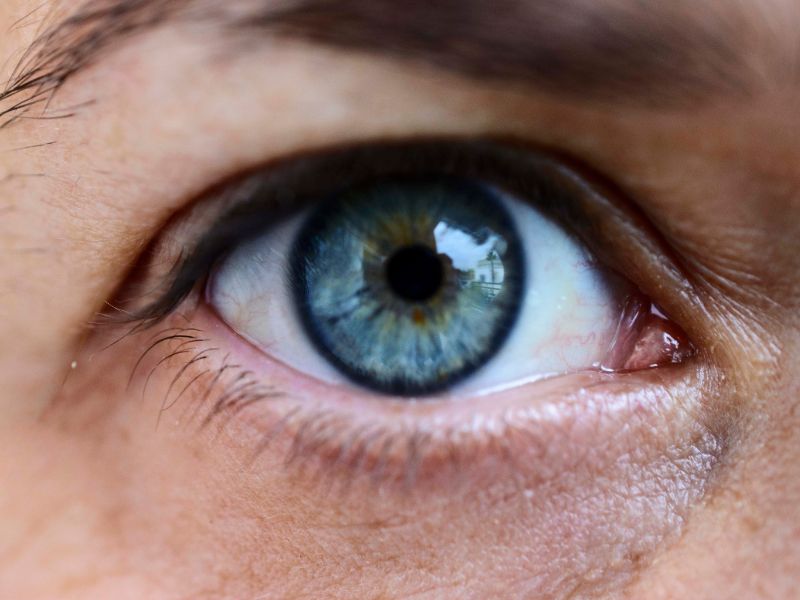 Cirurgia de Calázio e Tumores Oculares em São José dos Pinhais